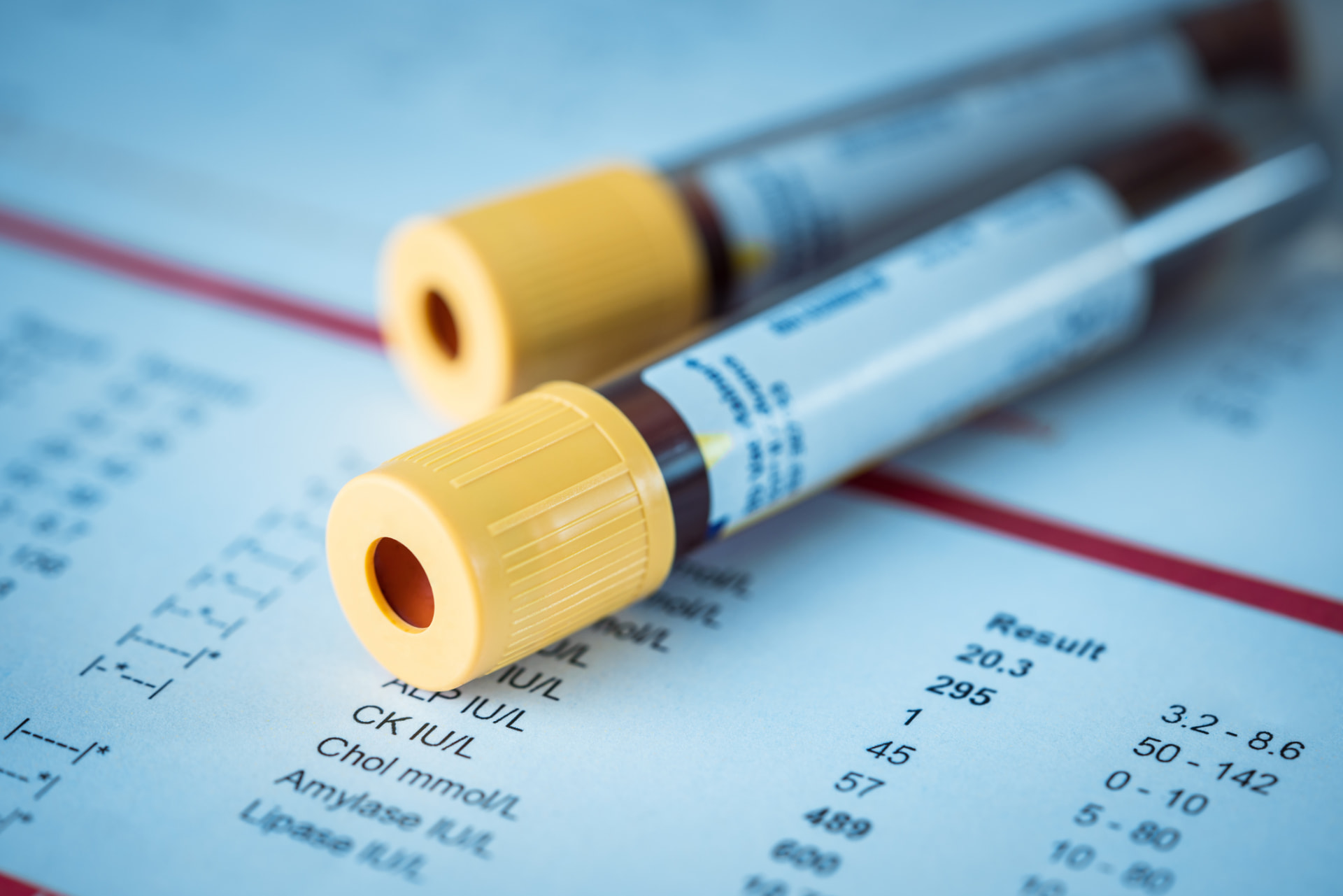 Blood collection tubes resting on a printed lab results report